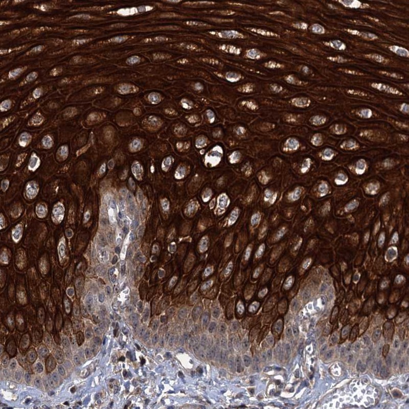 Atlas Antibodies Anti-ABLIM1 Antibody
