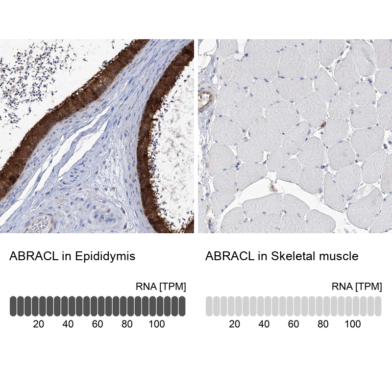 Atlas Antibodies Anti-ABRACL Antibody