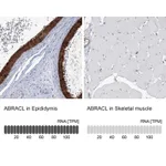 Atlas Antibodies Anti-ABRACL Antibody