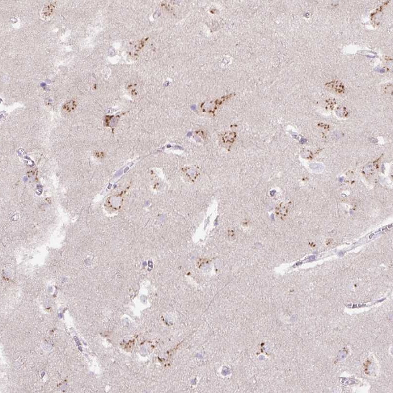 Atlas Antibodies Anti-ABR Antibody