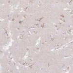 Atlas Antibodies Anti-ABR Antibody