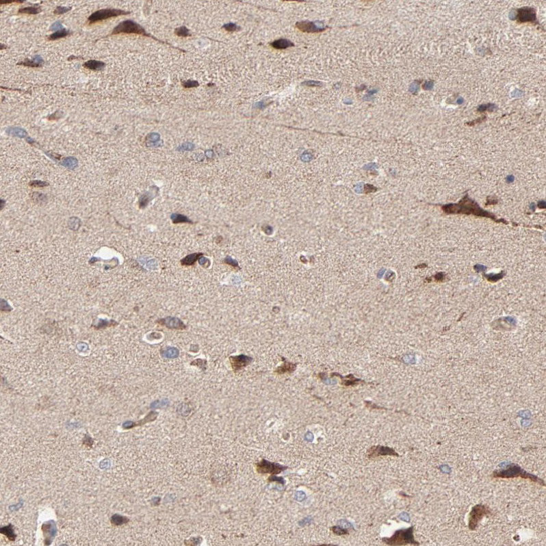 Atlas Antibodies Anti-ABLIM3 Antibody