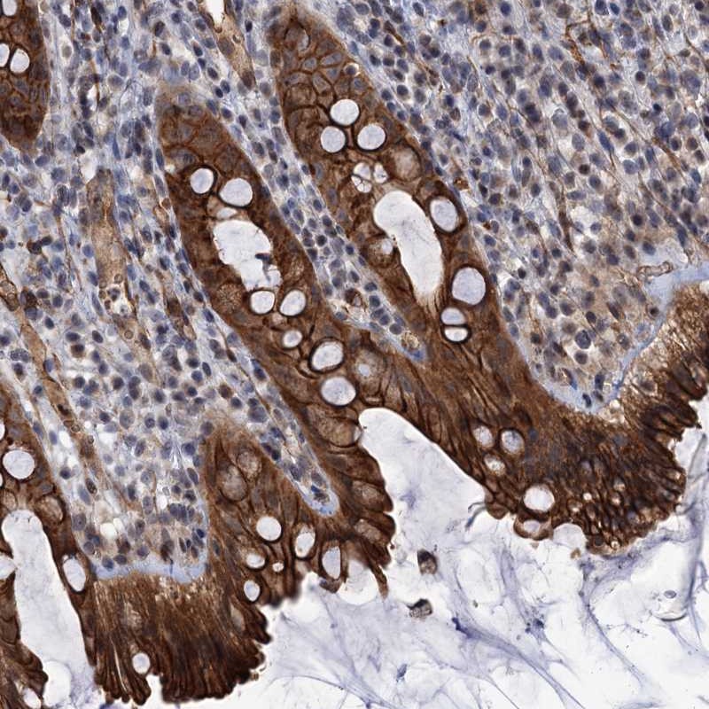 Atlas Antibodies Anti-ABLIM1 Antibody