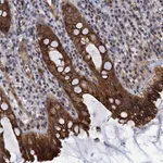 Atlas Antibodies Anti-ABLIM1 Antibody