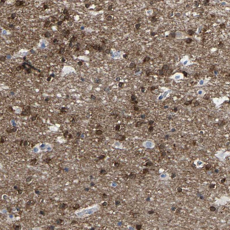 Atlas Antibodies Anti-ABTB2 Antibody