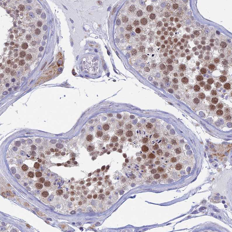 Atlas Antibodies Anti-AC004381.6 Antibody