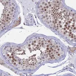 Atlas Antibodies Anti-AC004381.6 Antibody