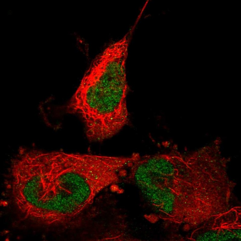Atlas Antibodies Anti-ABTB2 Antibody
