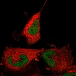 Atlas Antibodies Anti-ABTB2 Antibody