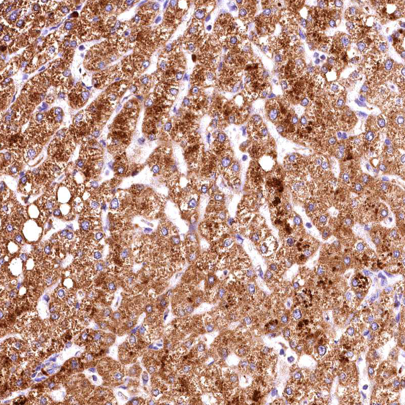 Atlas Antibodies Anti-ACAA2 Antibody