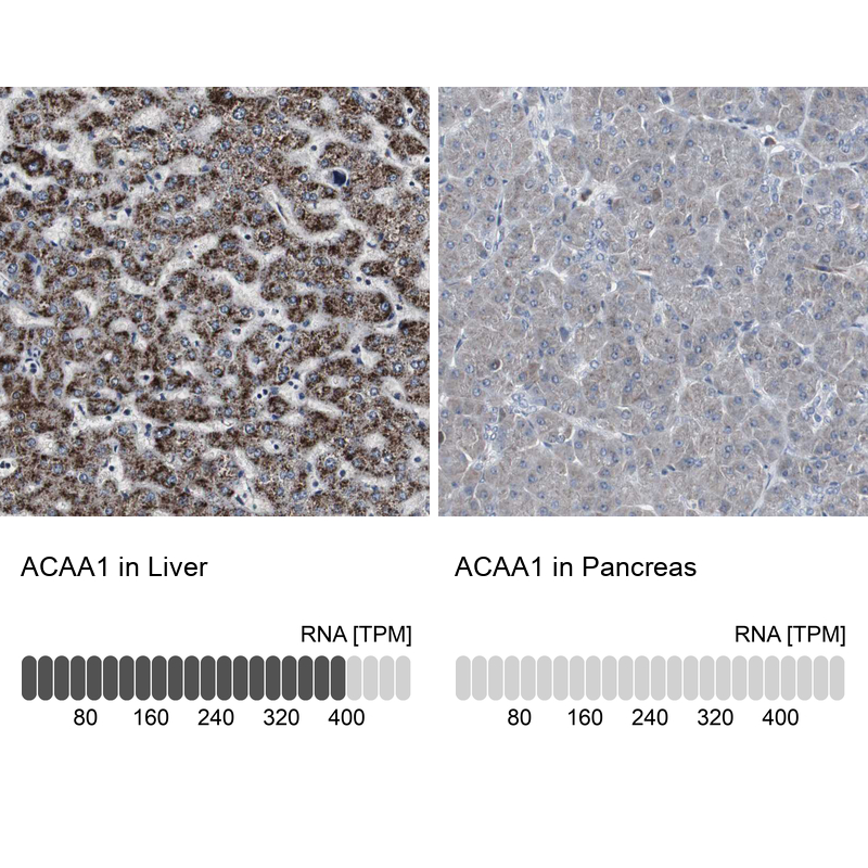 Atlas Antibodies Anti-ACAA1 Antibody