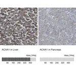 Atlas Antibodies Anti-ACAA1 Antibody