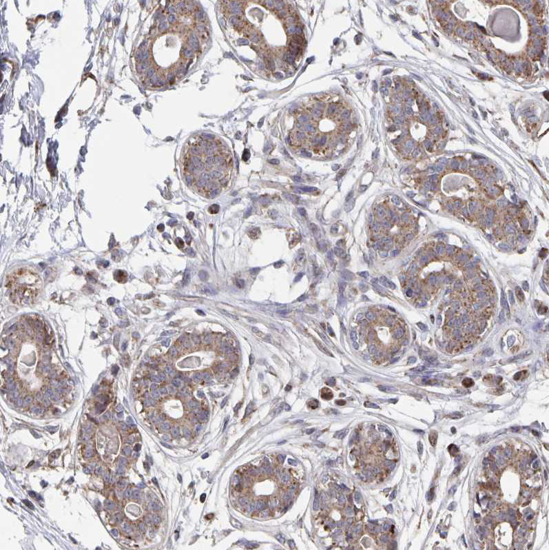 Atlas Antibodies Anti-ACACA Antibody