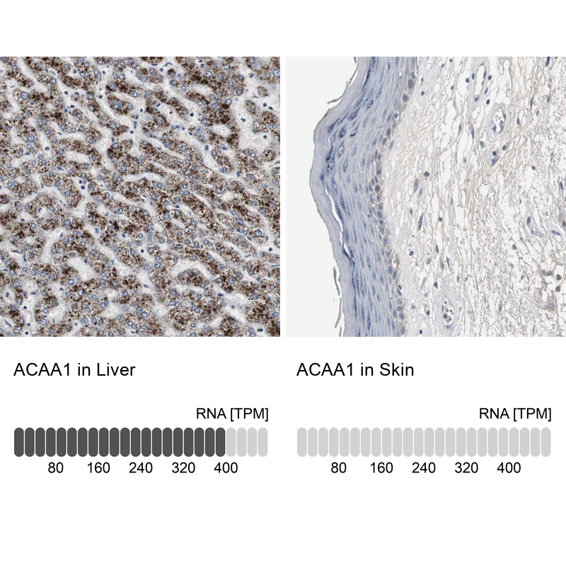 Atlas Antibodies Anti-ACAA1 Antibody