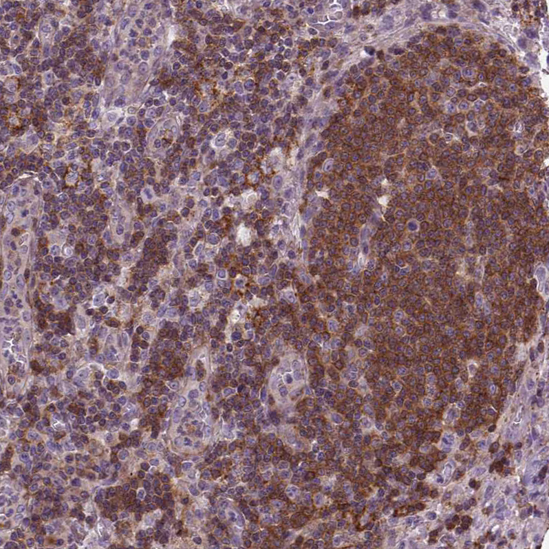 Atlas Antibodies Anti-ACAD10 Antibody