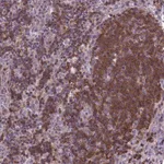 Atlas Antibodies Anti-ACAD10 Antibody