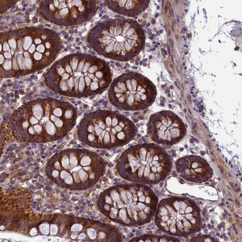Atlas Antibodies Anti-ACAD8 Antibody