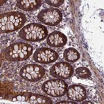 Atlas Antibodies Anti-ACAD8 Antibody