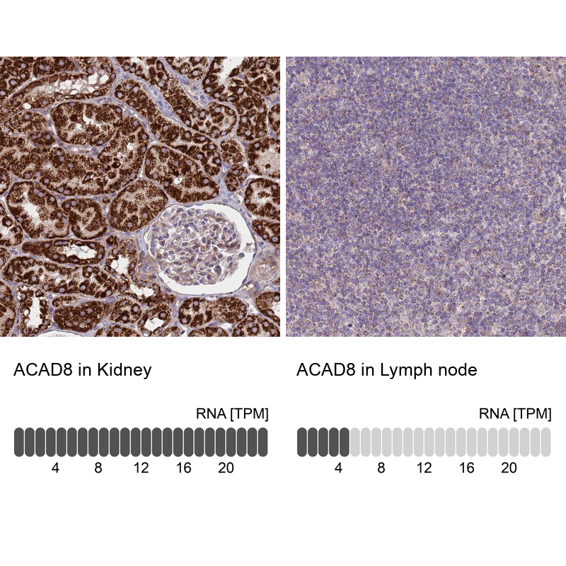Atlas Antibodies Anti-ACAD8 Antibody