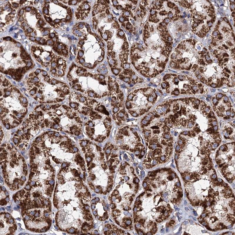 Atlas Antibodies Anti-ACAD9 Antibody