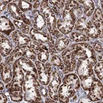 Atlas Antibodies Anti-ACAD9 Antibody