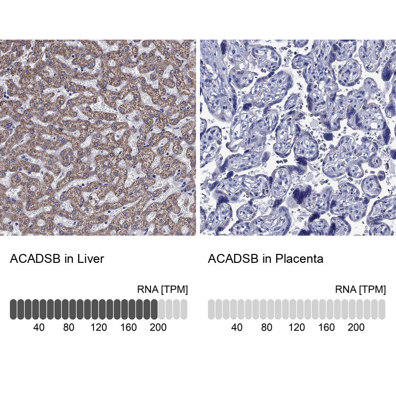 Atlas Antibodies Anti-ACADSB Antibody