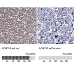 Atlas Antibodies Anti-ACADSB Antibody