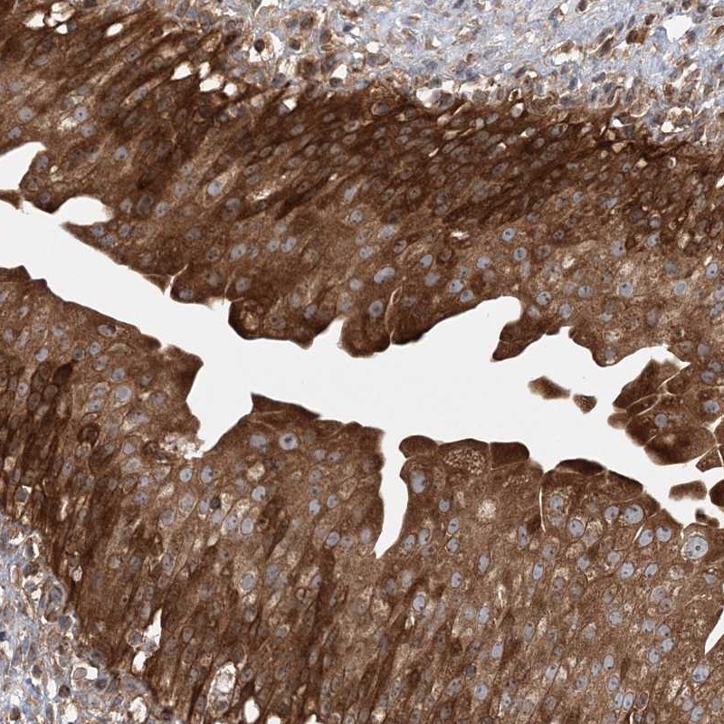 Atlas Antibodies Anti-ACAP2 Antibody