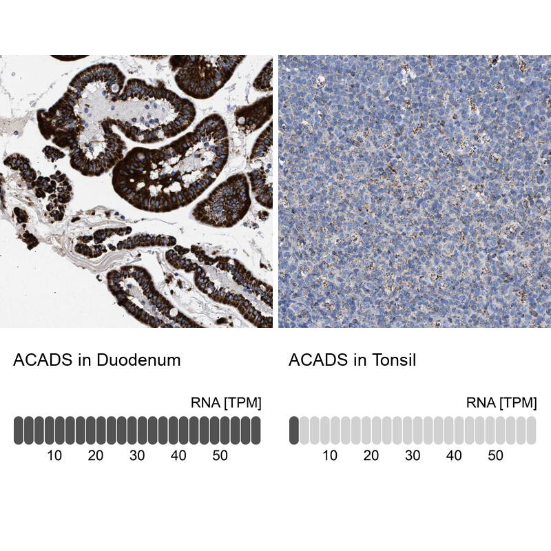 Atlas Antibodies Anti-ACADS Antibody