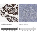 Atlas Antibodies Anti-ACADS Antibody