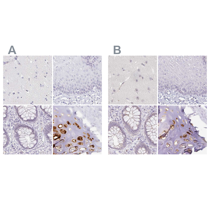 Atlas Antibodies Anti-ACAN Antibody