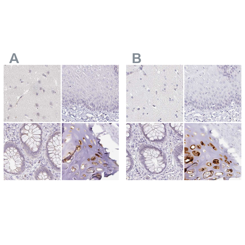 Atlas Antibodies Anti-ACAN Antibody