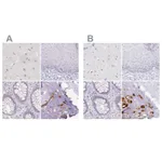 Atlas Antibodies Anti-ACAN Antibody