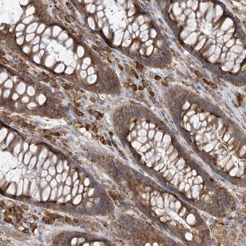 Atlas Antibodies Anti-ACAP2 Antibody