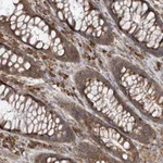 Atlas Antibodies Anti-ACAP2 Antibody