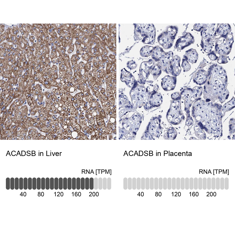 Atlas Antibodies Anti-ACADSB Antibody
