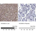 Atlas Antibodies Anti-ACADSB Antibody