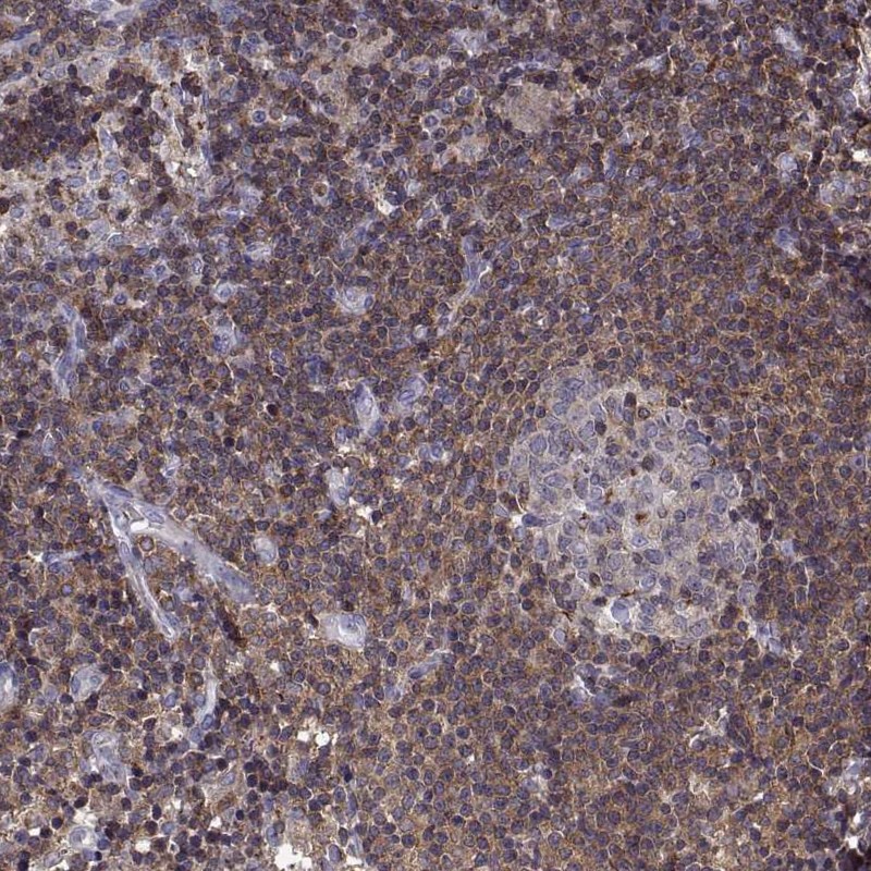 Atlas Antibodies Anti-ACAP1 Antibody
