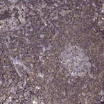 Atlas Antibodies Anti-ACAP1 Antibody