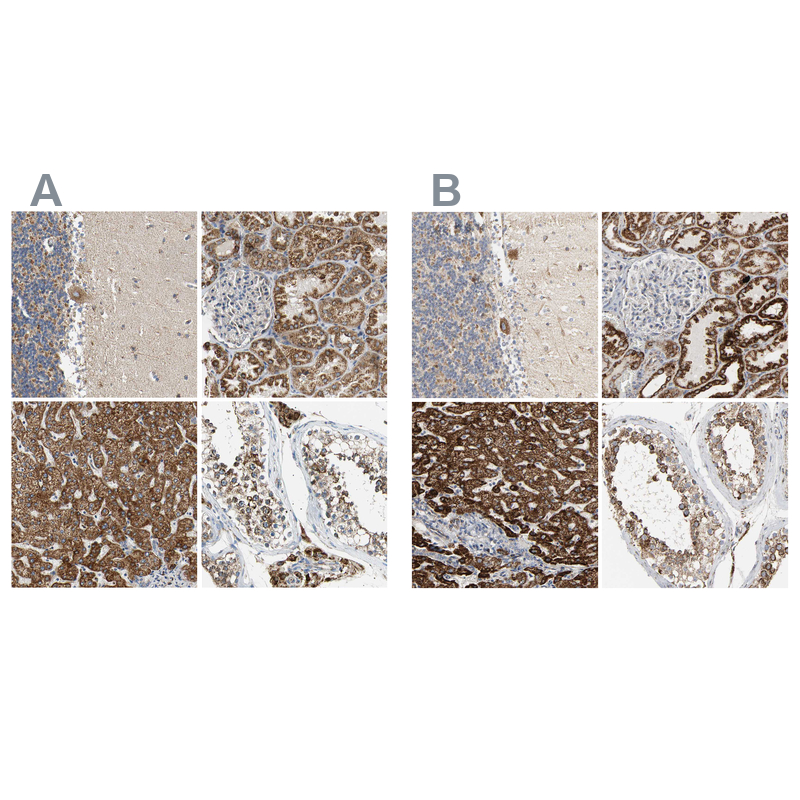 Atlas Antibodies Anti-ACAT1 Antibody