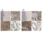 Atlas Antibodies Anti-ACAT1 Antibody