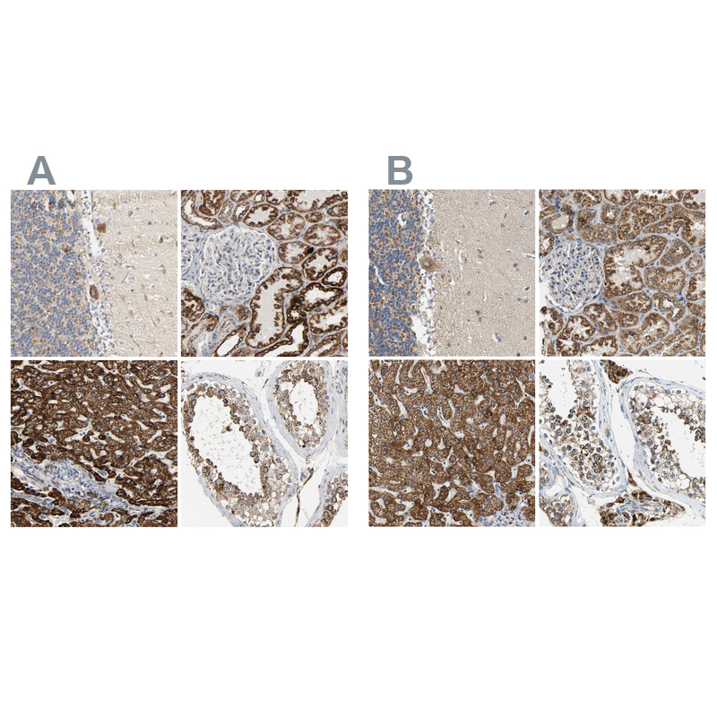 Atlas Antibodies Anti-ACAT1 Antibody