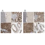 Atlas Antibodies Anti-ACAT1 Antibody