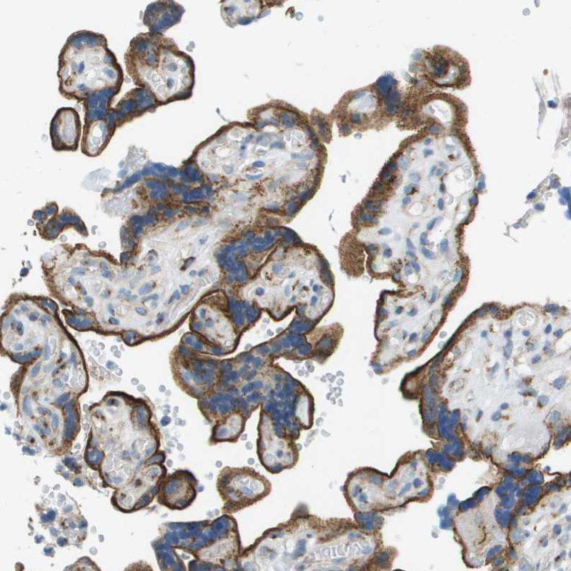 Atlas Antibodies Anti-ACBD3 Antibody