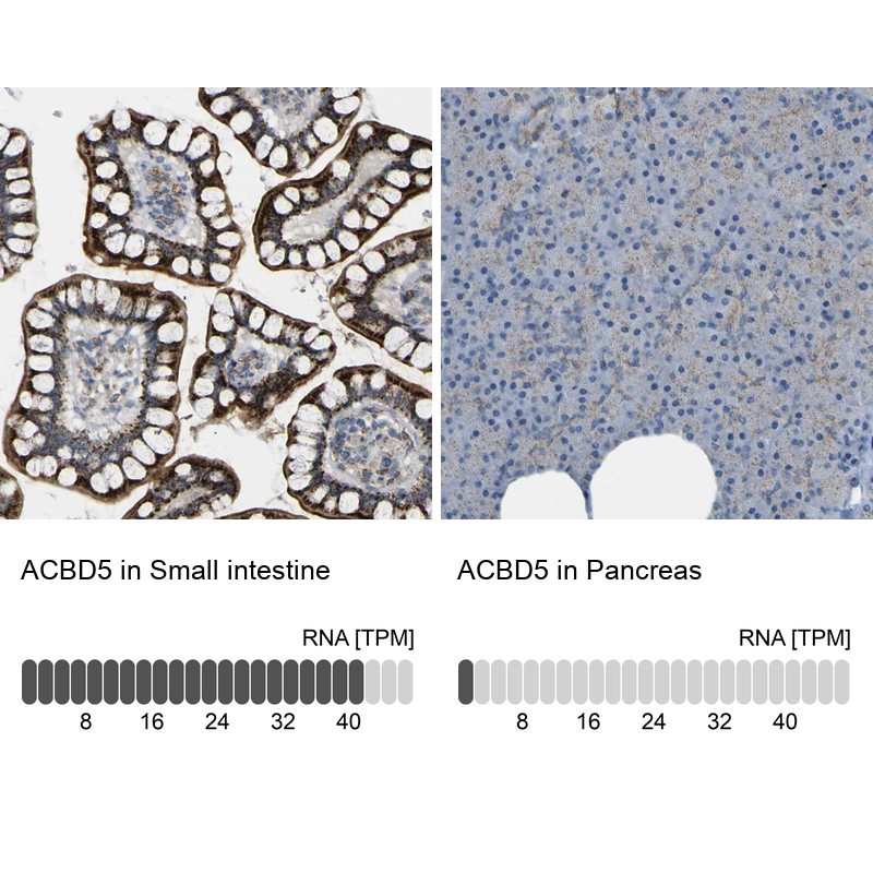 Atlas Antibodies Anti-ACBD5 Antibody