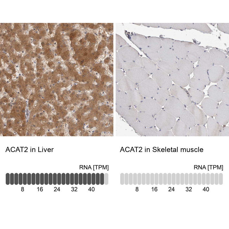Atlas Antibodies Anti-ACAT2 Antibody