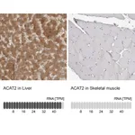 Atlas Antibodies Anti-ACAT2 Antibody