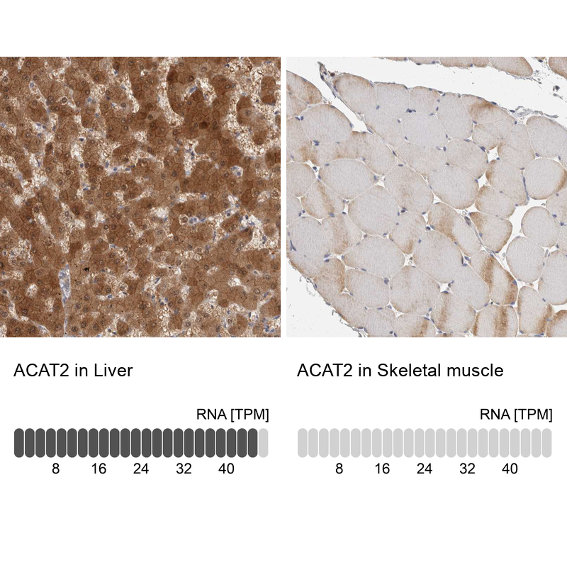 Atlas Antibodies Anti-ACAT2 Antibody