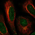 Atlas Antibodies Anti-ACAP3 Antibody