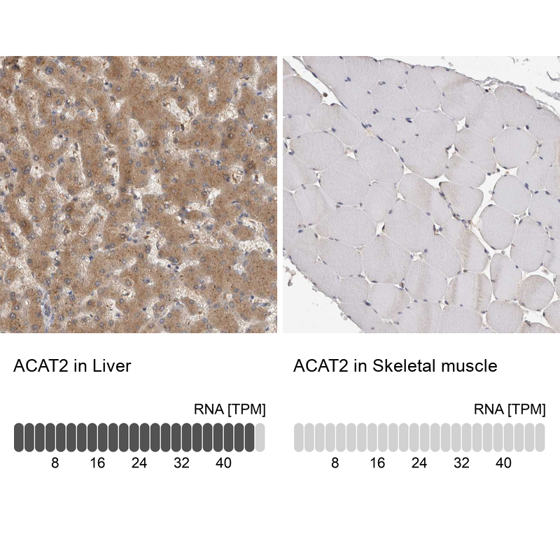 Atlas Antibodies Anti-ACAT2 Antibody